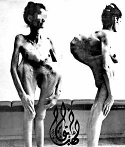 As the Chastened Angels Descend into the Thoraic Tombs